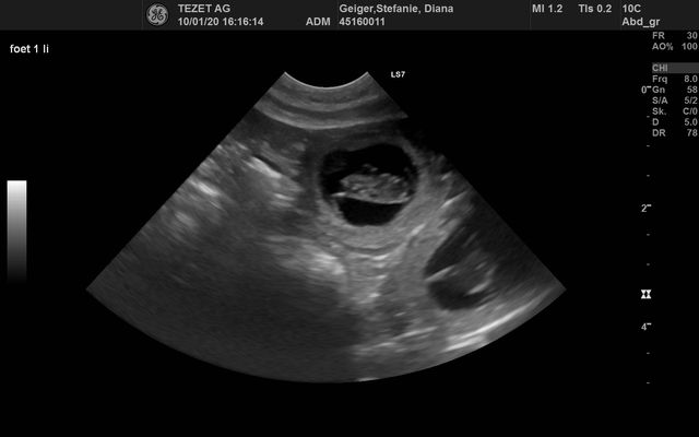 Ultraschall Diana